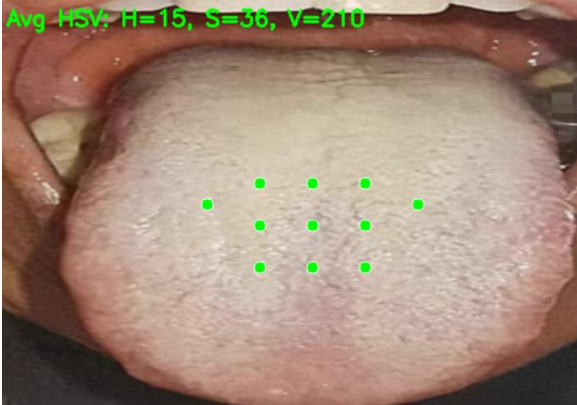 Regimen at Your Finger: An Application Based on Traditional Chinese Medicine​